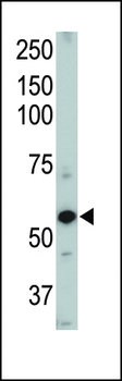 ACVRL1 Antibody (N-term)