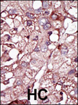 ACVRL1 Antibody (N-term)