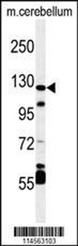 HIF1Alpha Antibody (C-term)