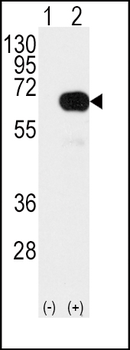 SMAD4 Antibody (T277)