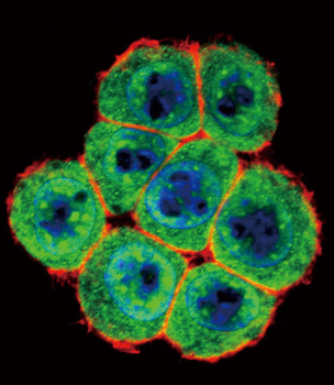 SMAD4 Antibody (T277)