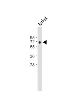 RUNX2 Antibody (S533)