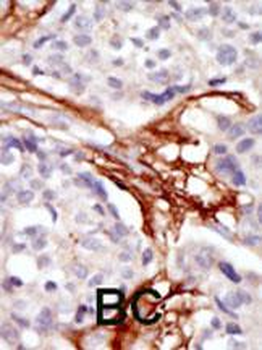 YES1 Antibody (N-term)