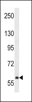 TEC Antibody (Center)