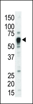 TEC Antibody (Center)