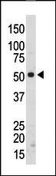 SRMS Antibody (C-term)