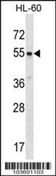SRMS Antibody (C-term)