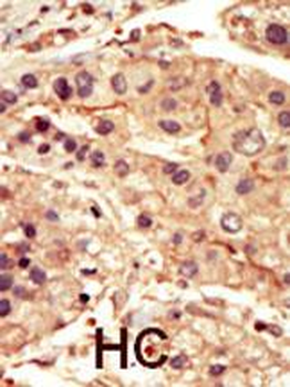 SRMS Antibody (C-term)