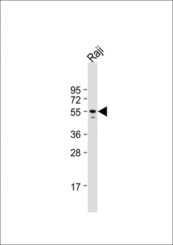 LYN Antibody (N-term)