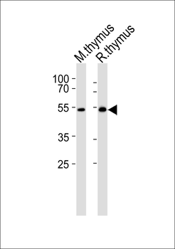 LCK Antibody (N-term)