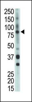 BMX Antibody (Center)