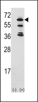 ACK1 Antibody (Center)