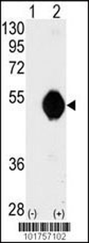 DOK2 Antibody (C-term)
