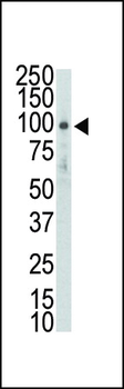 DDR2 (TYRO10) Antibody