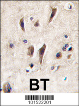TIE Antibody (N-term)