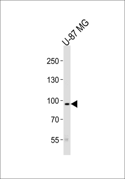TYRO3 Antibody