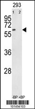 RYK Antibody (C-term)