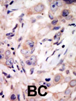 ROR2 Antibody (C-term)