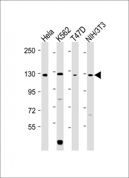 ROR2 Antibody (C-term)