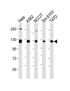 ROR2 Antibody (C-term)