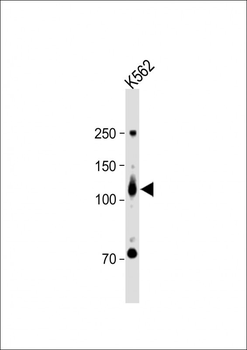 ROR2 Antibody (N-term)