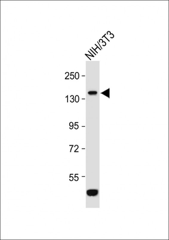 ROR1 Antibody (N-term)