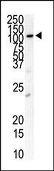 PDGFRB Antibody (N-term)