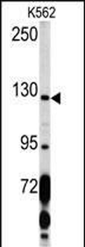 PDGFRA Antibody (C-term E1063)