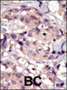 PDGFRA Antibody (C-term E1063)