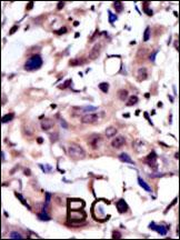 MUSK Antibody (N-term)