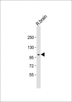 DDR1 Antibody (N-term)