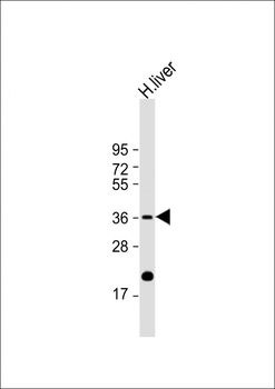 IGFBP3 Antibody (S183)