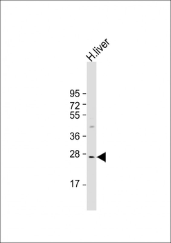 IGFBP3 Antibody (S183)