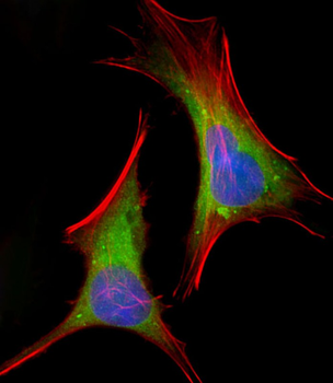 FGFR2 Antibody (N-term)