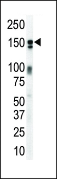 ERBB3 Antibody (N-term)