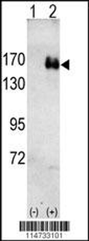 ERBB2 Antibody