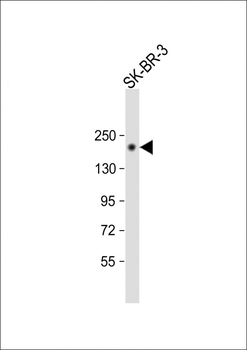 ErbB2 (C-term) Antibody
