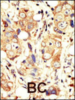 ErbB2 (C-term) Antibody