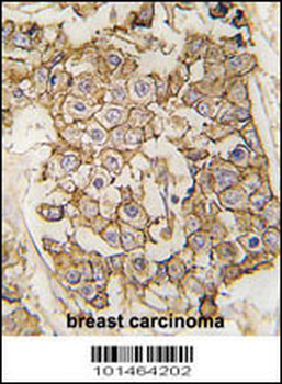ERBB2 Antibody(N-term)