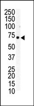 EphB6 Antibody (C-term H990)
