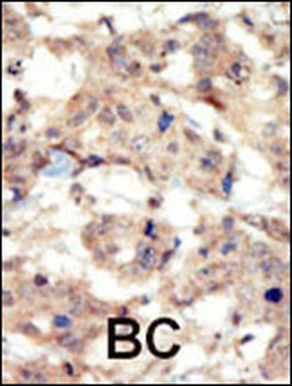 EphB6 Antibody (N-term S45)