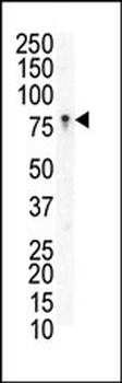 EphB3 Antibody (N-term)