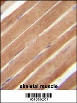 EphB2 Antibody (N-term)