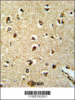 SEPT4 Antibody (N-term)