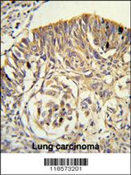 PLTP Antibody (C-term)
