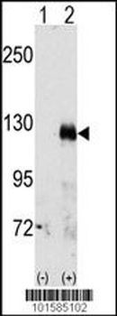 EphA3 Antibody (C-term)
