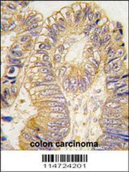 CLIC5 Antibody
