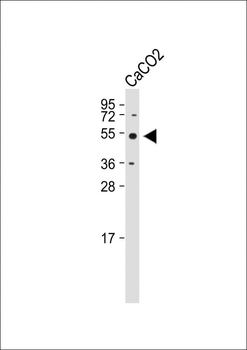 HARS Antibody (N-term)