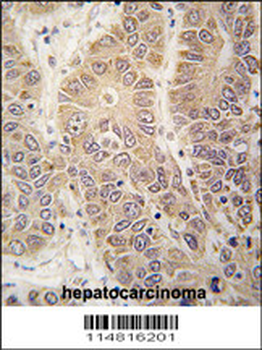 HARS Antibody (N-term)