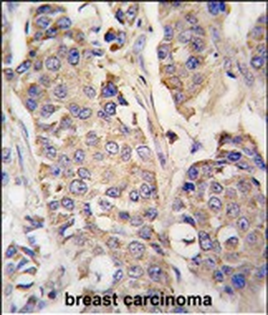 ACO2 Antibody (Center)
